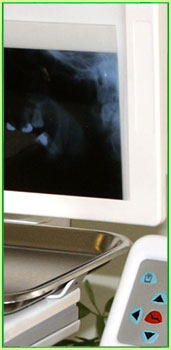 iyidisler.com